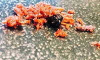 a pile of red and black berries on a table